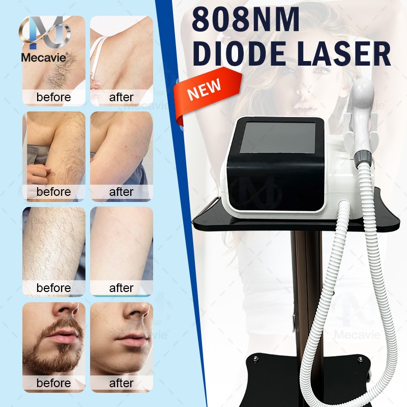 Industrial Laser Hair Removal Machine - Yeni 2026 4000W Mini Diyot Epilasyon